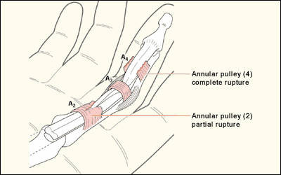 Taping Fingers in Rock Climbing